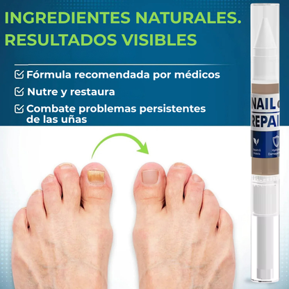 MyCurePro® Lápiz Antifúngico con Fórmula Avanzada – Contra Pie de Atleta y Hongos en Uñas